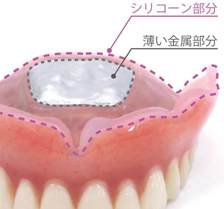 コンフォートデンチャー